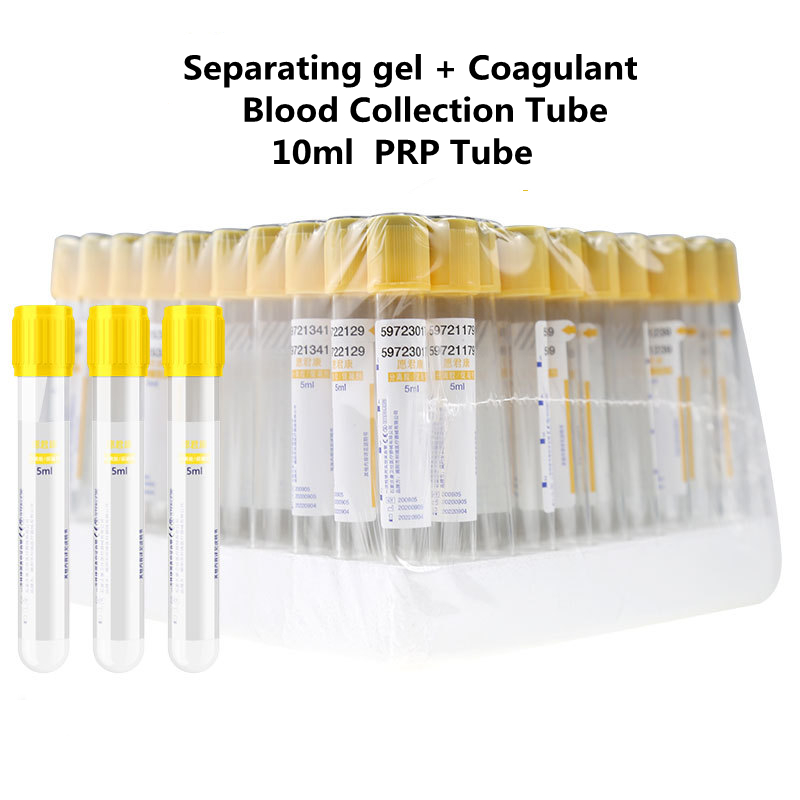 Medical Lab Blood Test - 일회용 진공 혈액 채취 튜브 분리