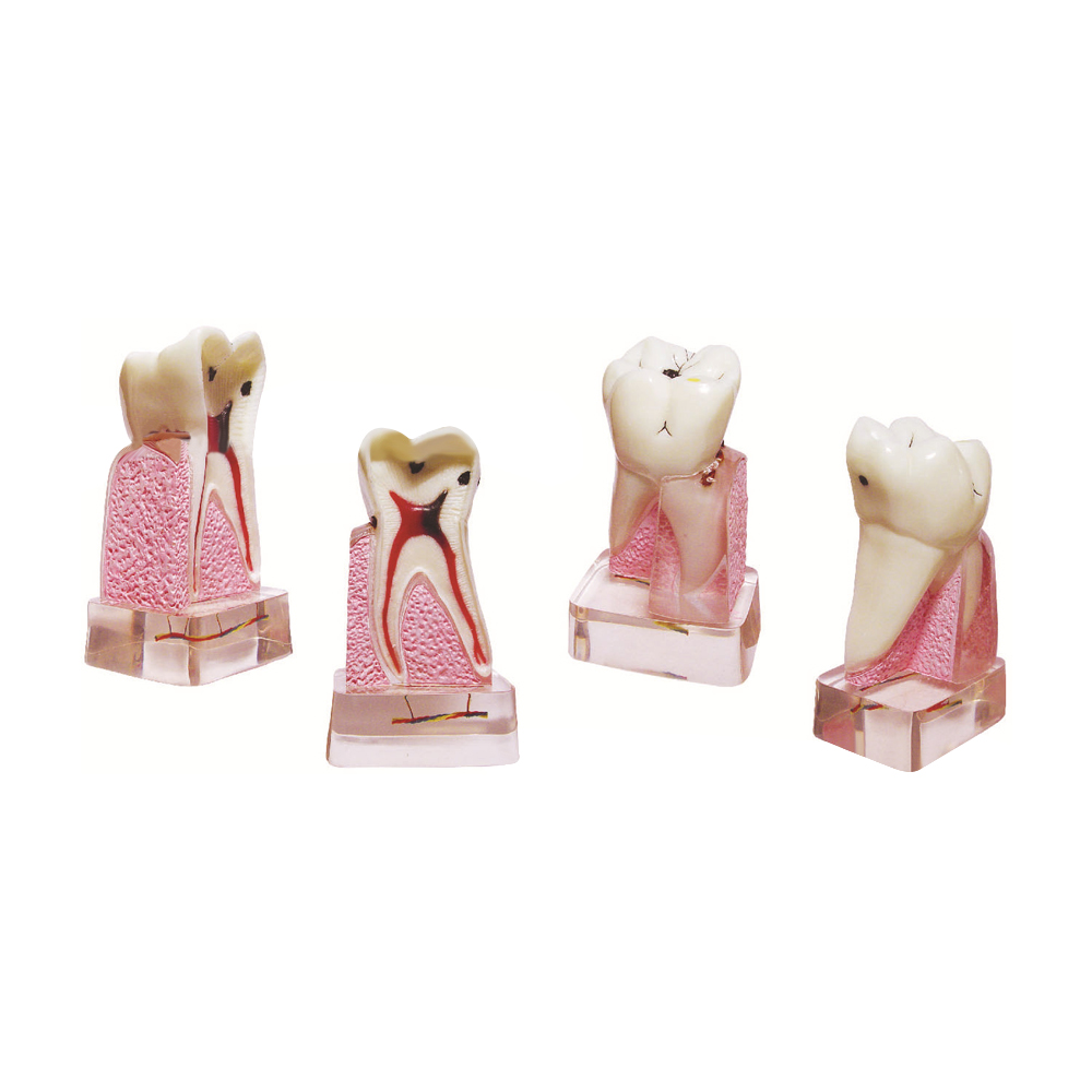 치과 병리학 모형, 4배 확대된 해부학적 치아 모형,  - Medical Lab Supplies 리뷰 및 가격