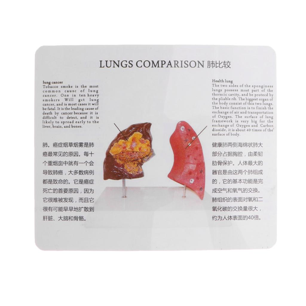 인간 폐 정상 비교 모델 PVC 교육용 도구 (의과대학 - Medical Lab Supplies 리뷰 및 가격
