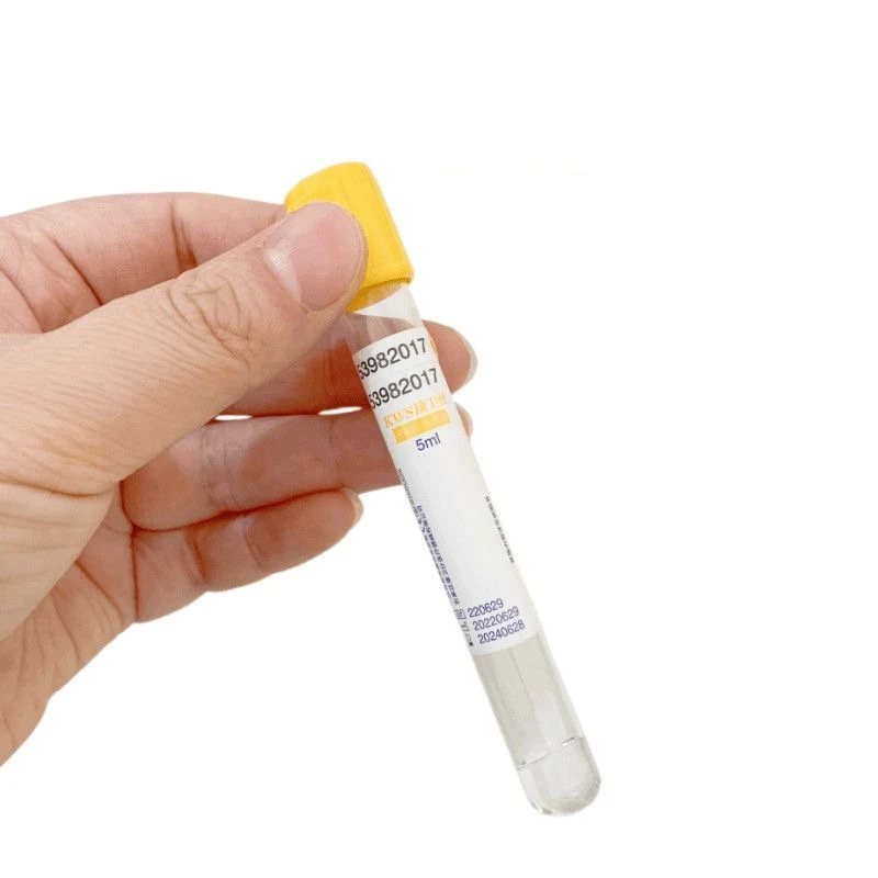 일회용 진공 혈액 채취 튜브 분리 젤 및 응고 활성제  - Medical Lab Blood Test 리뷰 및 가격