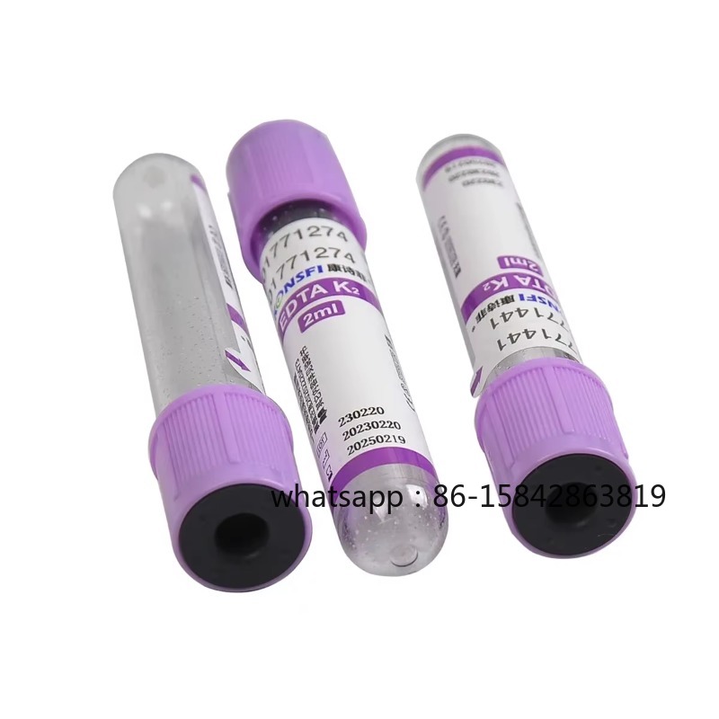 의료 실험실 진공 혈액 채취 응고/튜브/EDTA 튜브  - Medical Lab Supplies 리뷰 및 가격